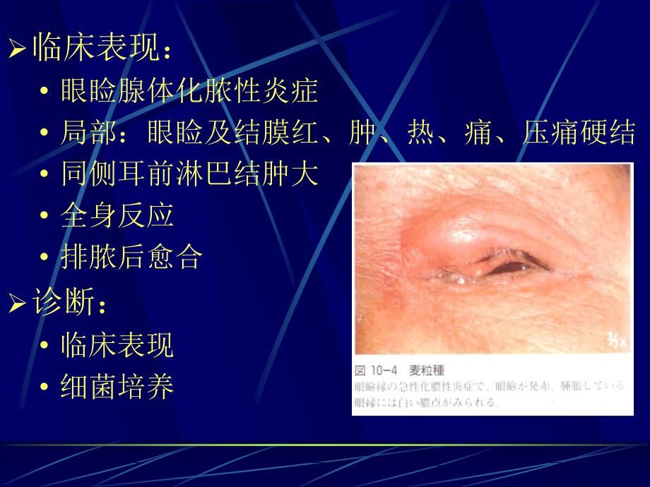 （ppt）第四章眼睑病课件_第4页