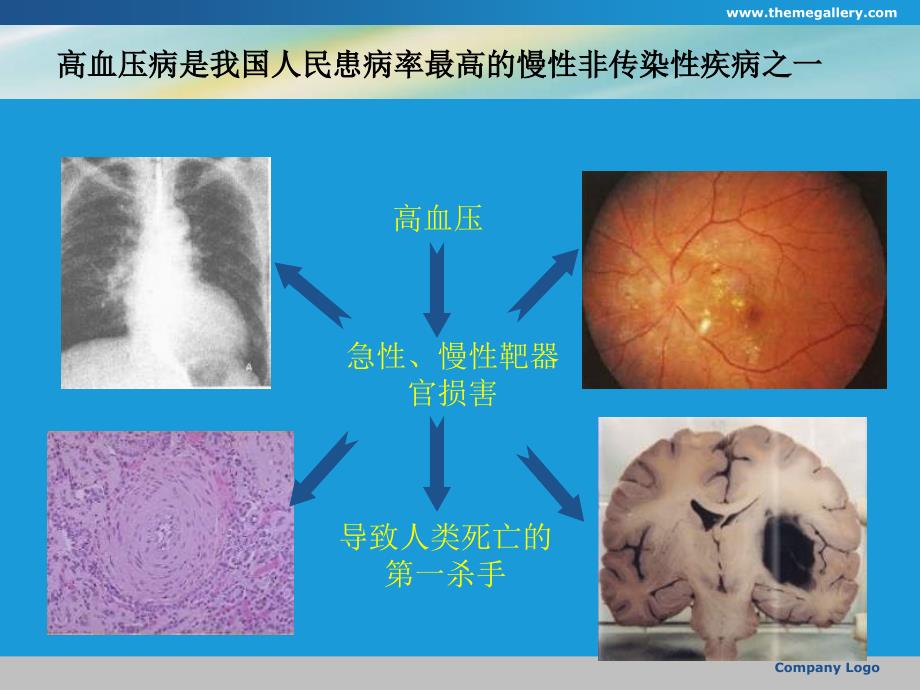 降压治疗对循环内皮微颗粒水平与动脉弹性的影响课件_第3页