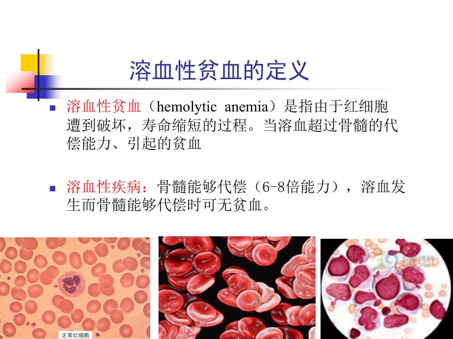 溶血性贫血_2课件_第4页