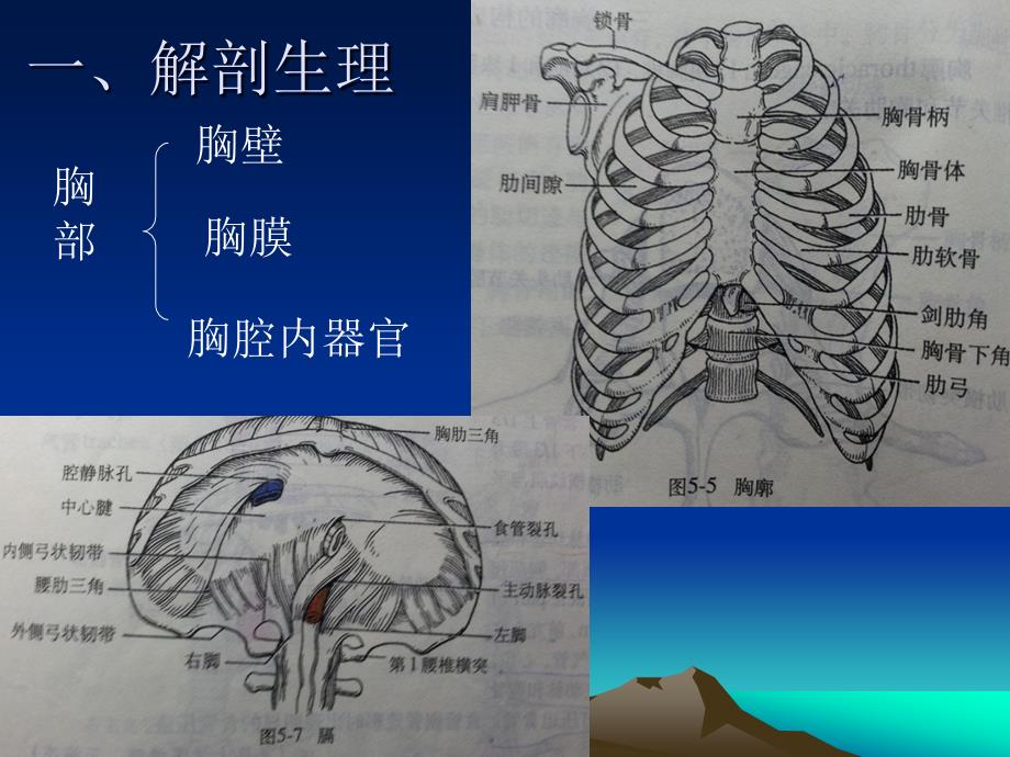 第十四章 胸部损伤病人的护理课件_第4页