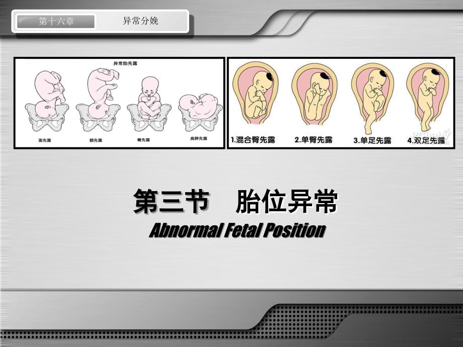 第八版妇产科配套演示稿_异常分娩 胎位异常讲解材料课件_第2页