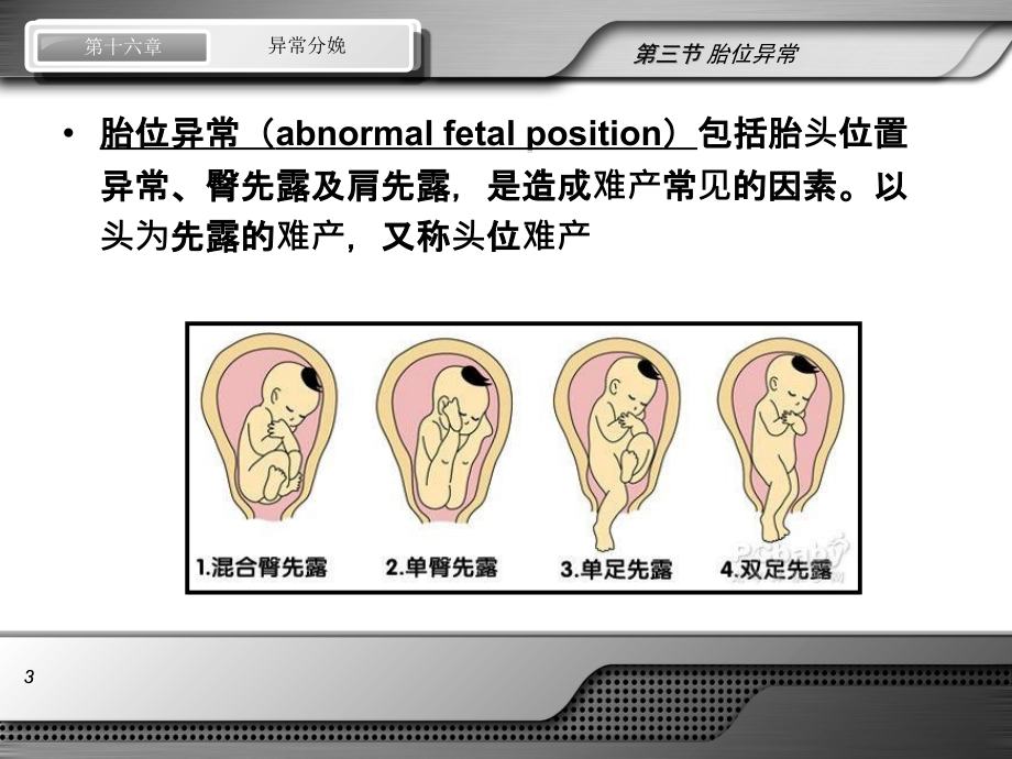 第八版妇产科配套演示稿_异常分娩 胎位异常讲解材料课件_第3页