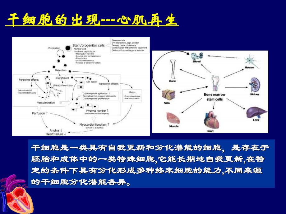 缺血性心脏病的干细胞治疗课件_第4页