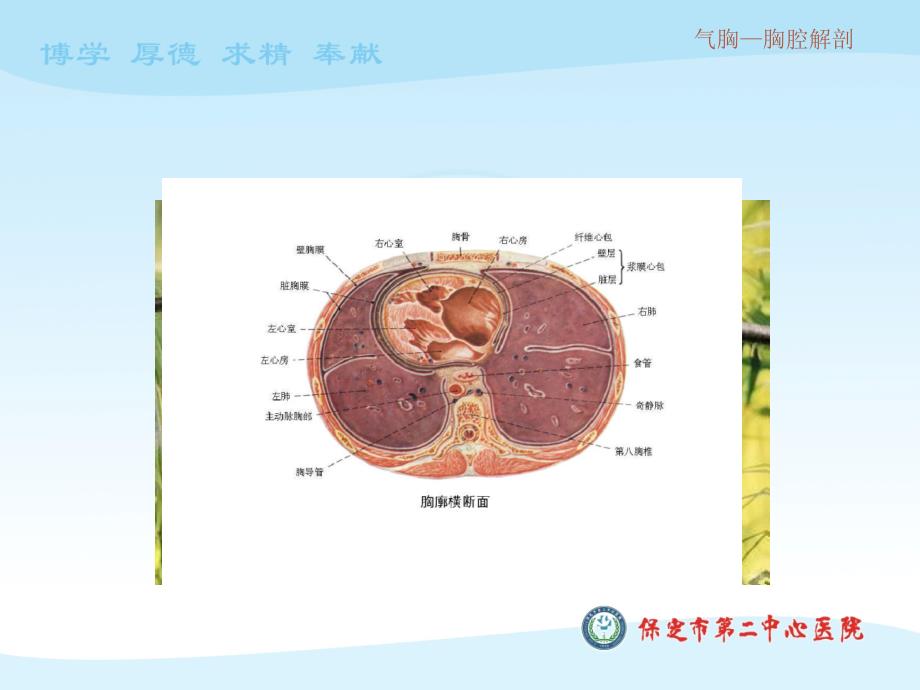 气胸最新课件_第4页