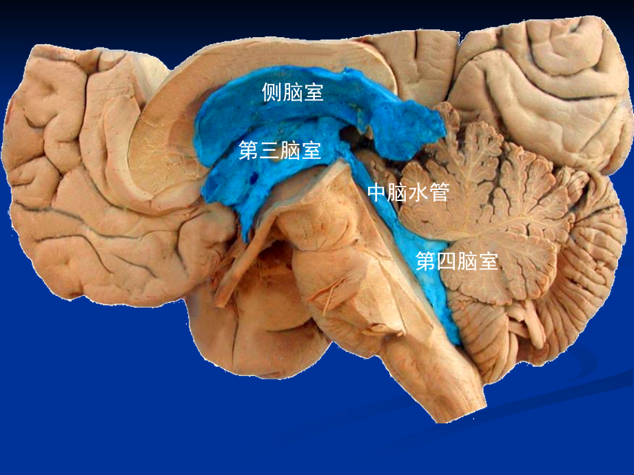 脑室系统解剖与第三脑室手术入路_第3页