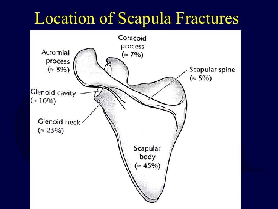 肩胛骨骨折（英文）课件_第5页