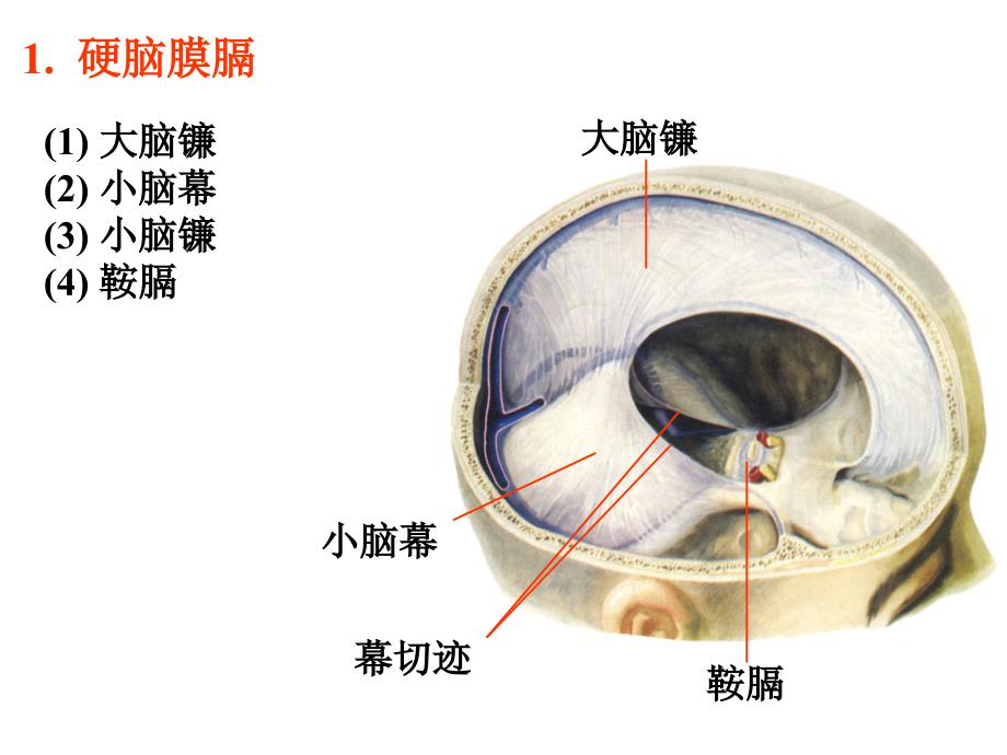 脑膜脑池脑室课件_第4页