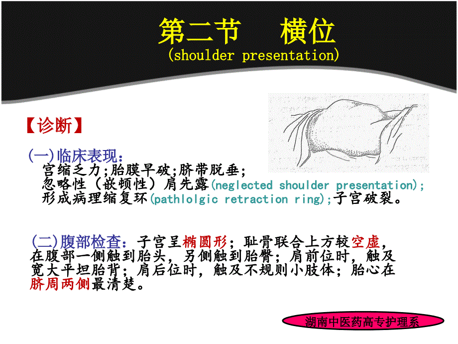 横位持续性枕横（后）位及胎头高直位课件_第4页