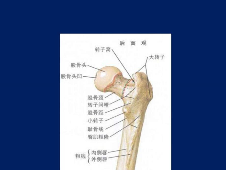 股骨粗隆间骨折ppt课件图文_第4页