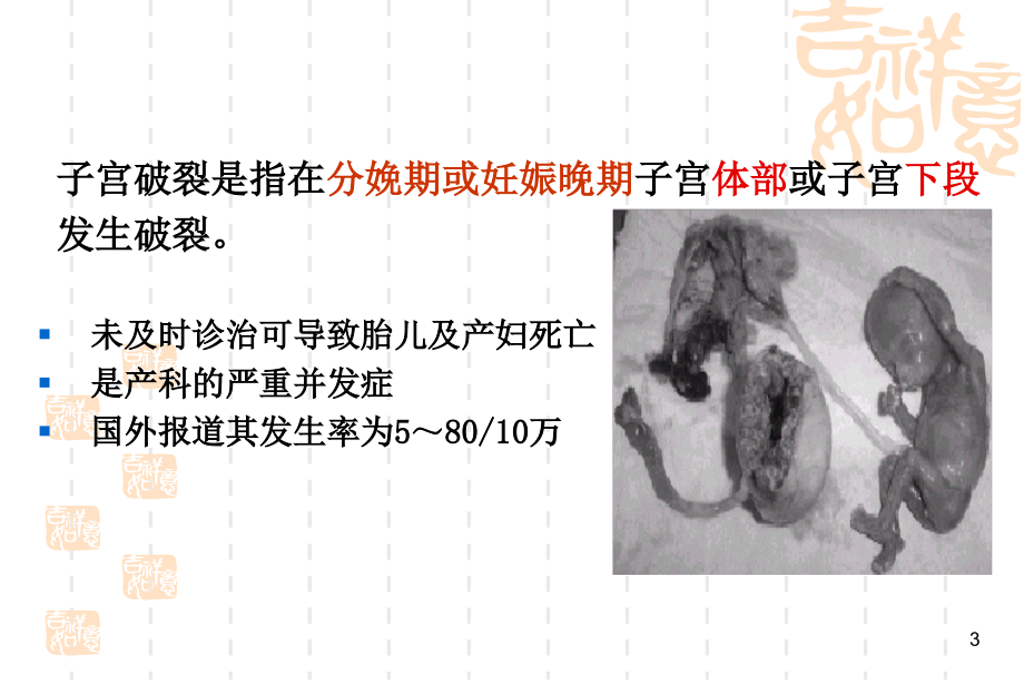 第十二章_分娩期并发症课件_第3页