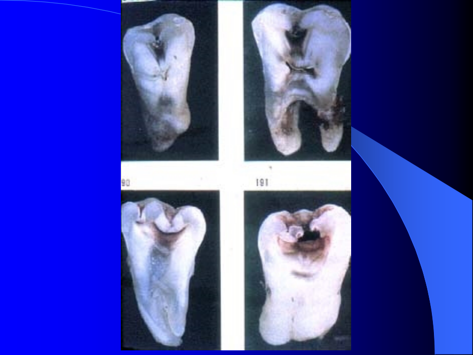 牙体牙髓病新版课件_第3页