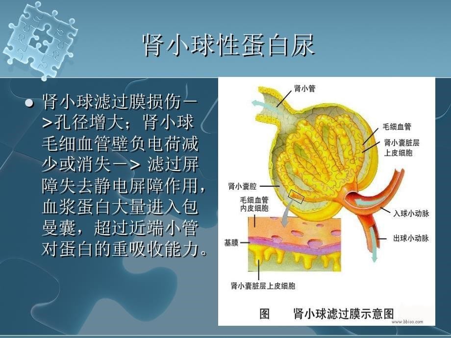 蛋白尿的诊断思路与技巧课件_第5页