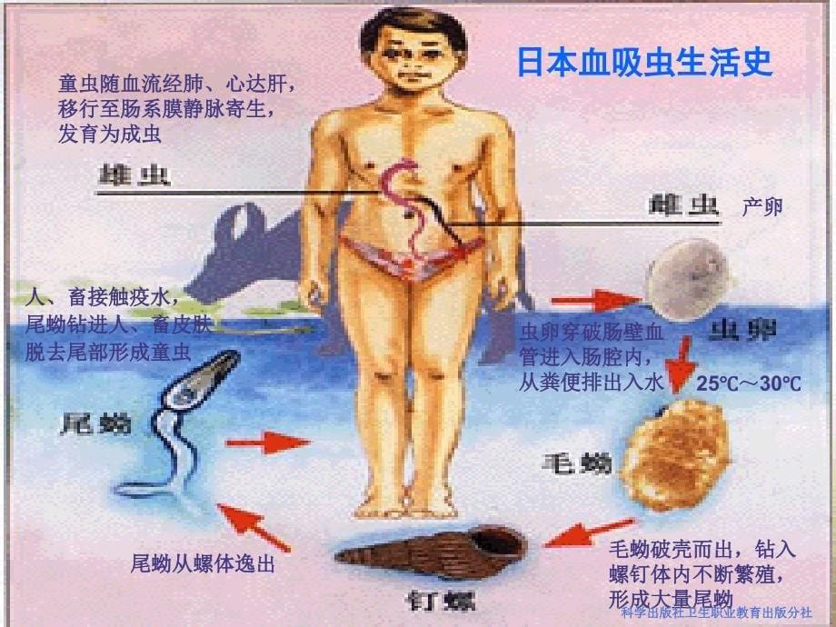 血吸虫病传染病护理课件_第5页