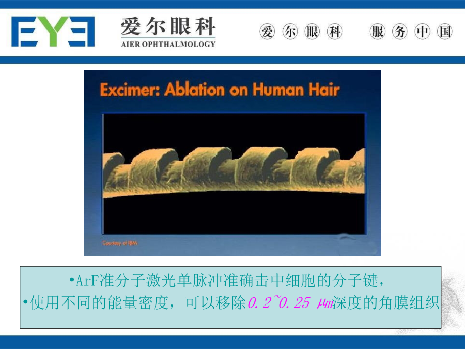 现代准分子激光治疗近视哈尔滨爱尔眼科医院课件_第3页