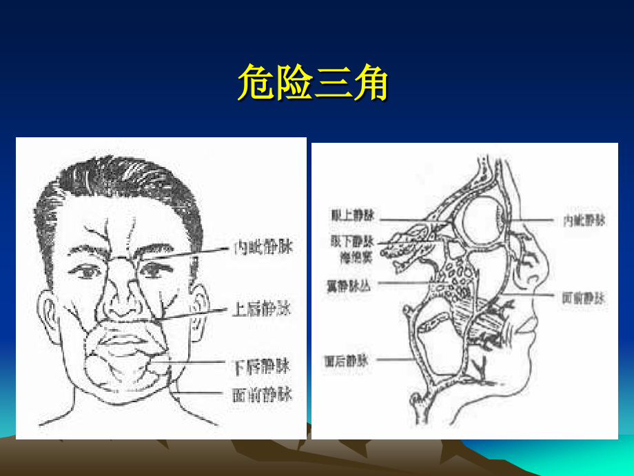 汕头大学口腔颌面部感染包括唾液腺炎课件_第4页