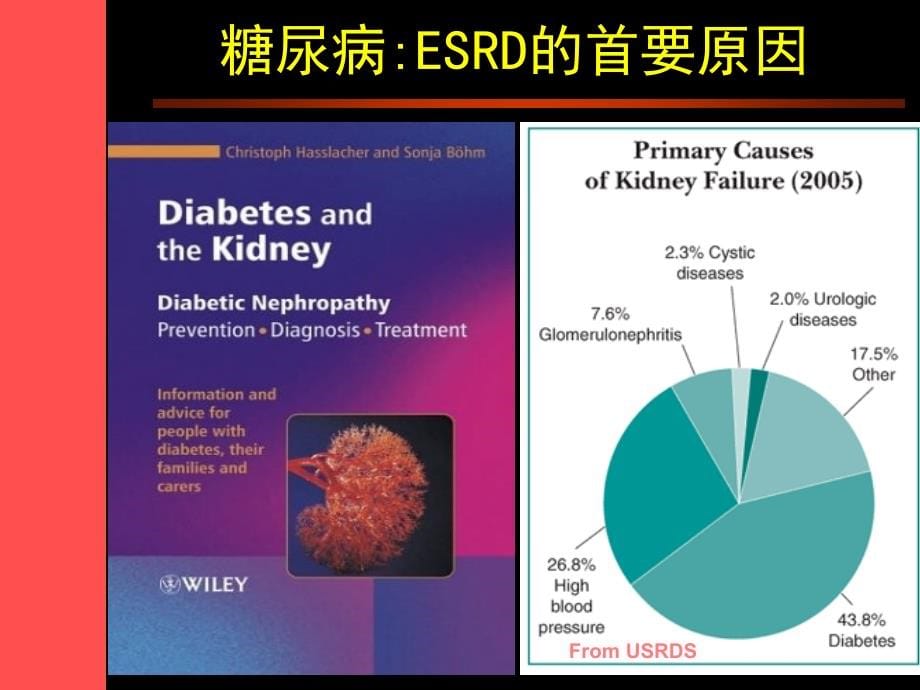 糖尿病肾病的诊疗进展课件_第5页