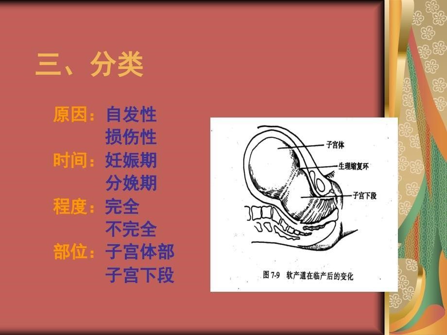 精品子宫破裂课件_第5页