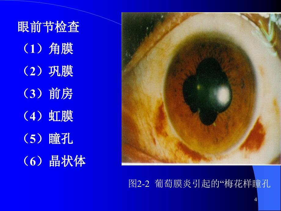 第2章  眼科病人护理概述课件_第4页