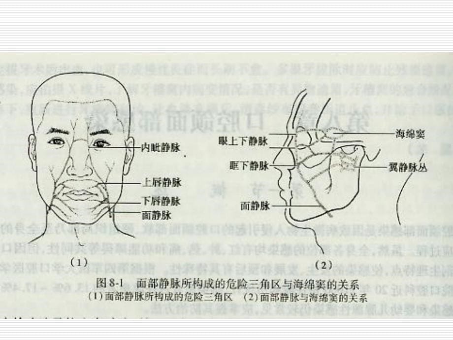 口腔颌面部感染(2013)_第5页