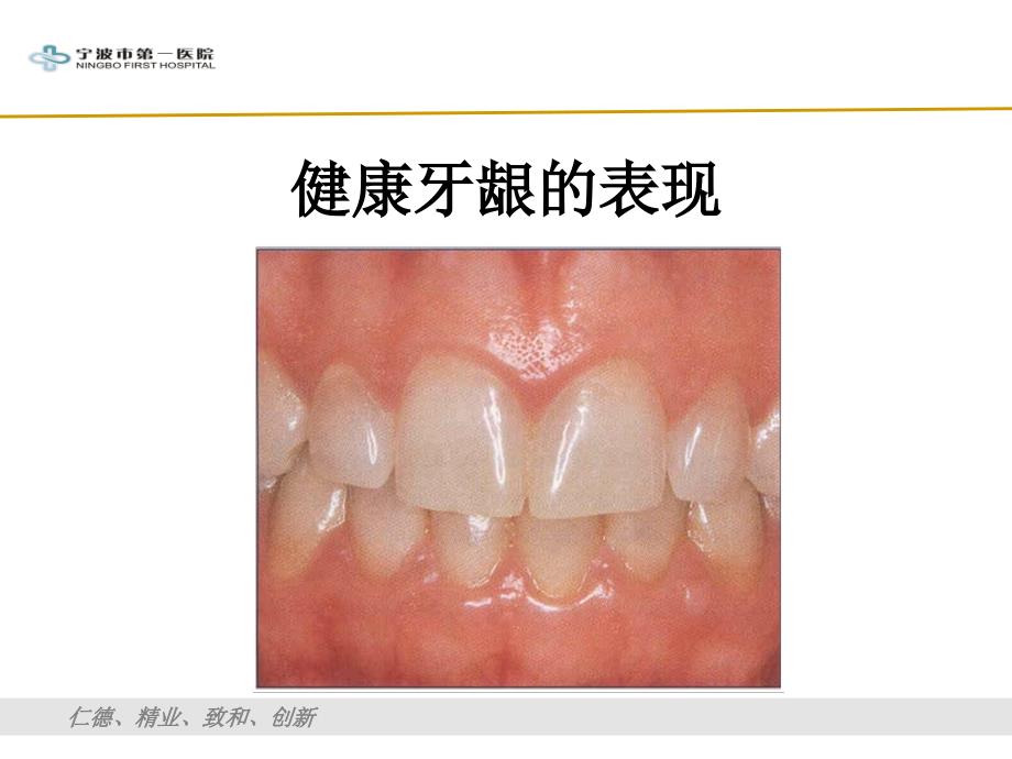 牙周炎与全身疾病（慢病发言）ppt课件_第2页