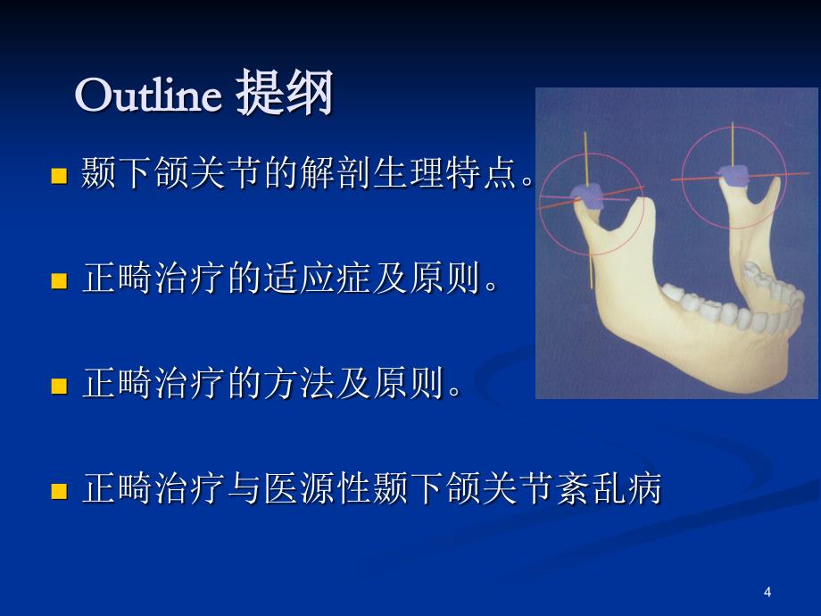 正畸与颞下颌关节的关系_1课件_第4页