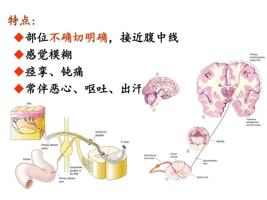 诊断学腹痛课件_第5页