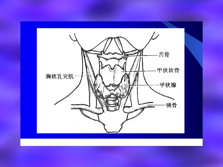 颏下皮样囊肿l颈前正中区甲状腺疾病甲状腺舌管囊肿2颈侧区l胸课件_第4页