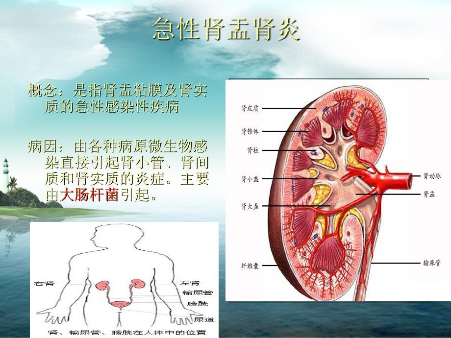 护理查房急性肾盂肾炎_ppt课件_第4页