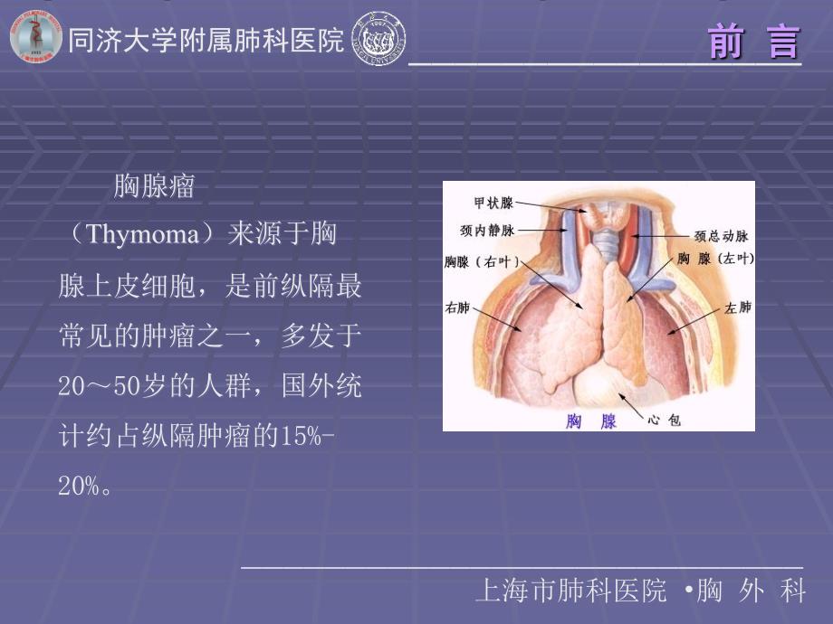 例胸腺瘤who分型及masaoka分期的回顾研究宋楠课件_第2页