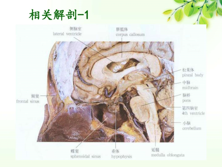 垂体瘤护理查房图文课件_1_第3页