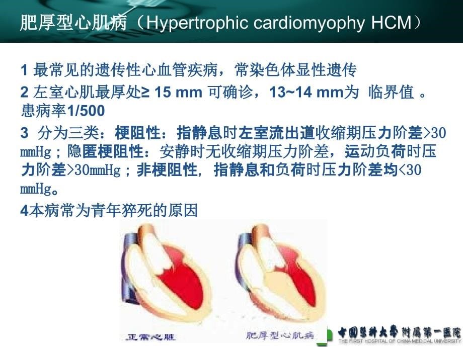 心肌病麻醉基础医学医药卫生专业资料课件_第5页