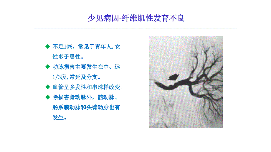 粥样硬化性肾动脉狭窄介入适应症的探讨图文课件_第4页