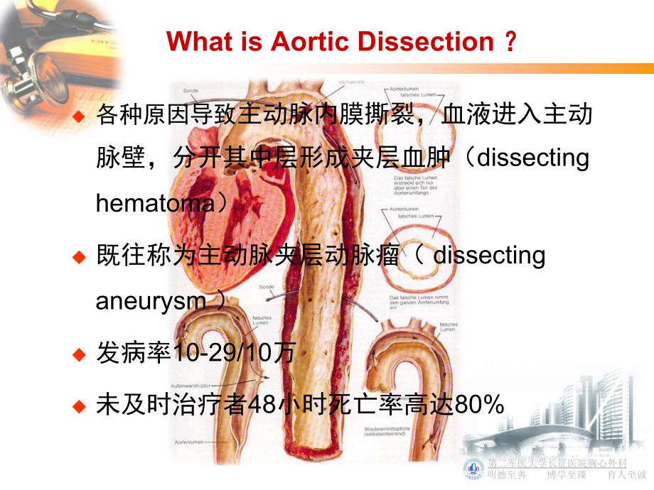 基础医学主动脉夹层外科治疗及围术期血压管理课件_第2页