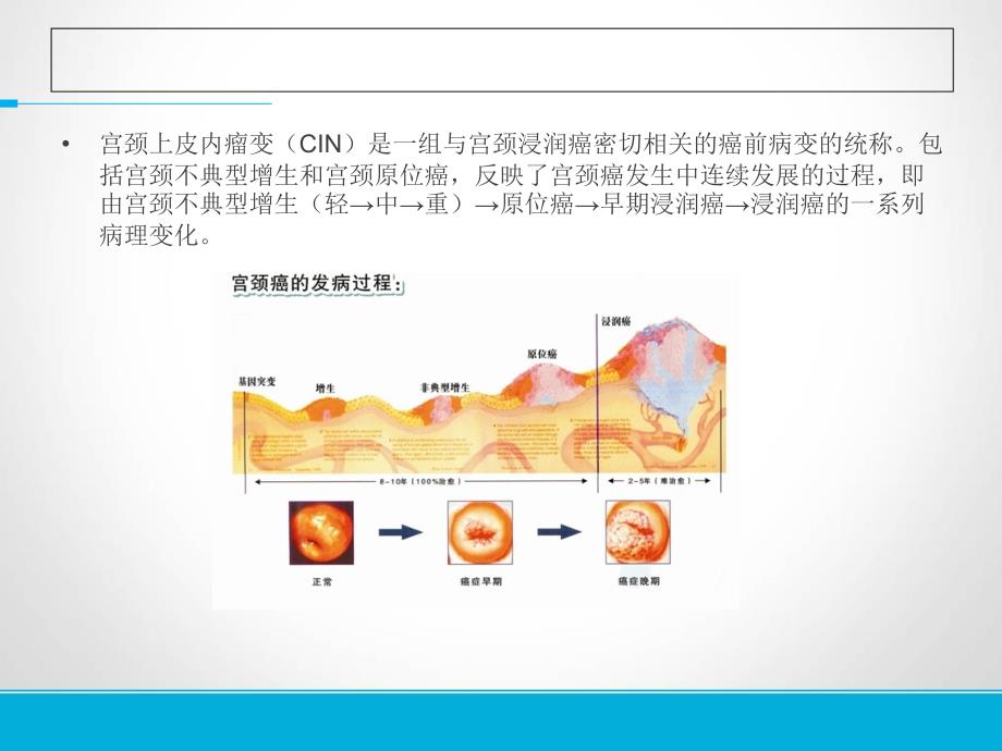 子宫颈上皮内瘤变（精编）课件_第2页