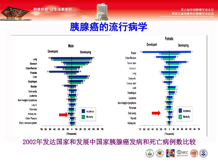 医学保健胰腺癌的诊治现状及展望课件_第4页