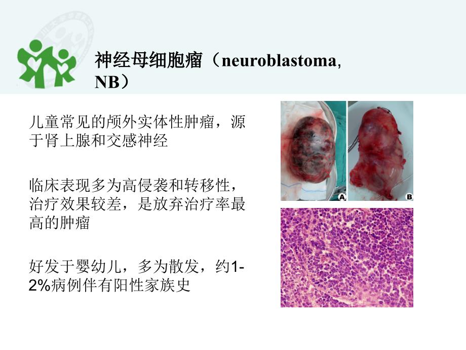 神经母细胞瘤中alk异常表达的分子机制及其临床意义课件_第2页