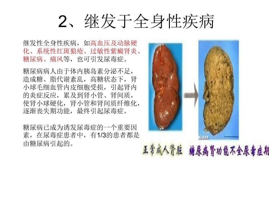 尿毒症研究（1）课件_第5页