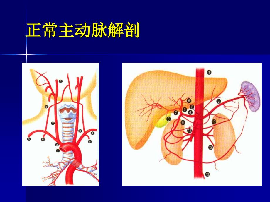 主动脉夹层及腹主动脉瘤cta影像课件_第3页