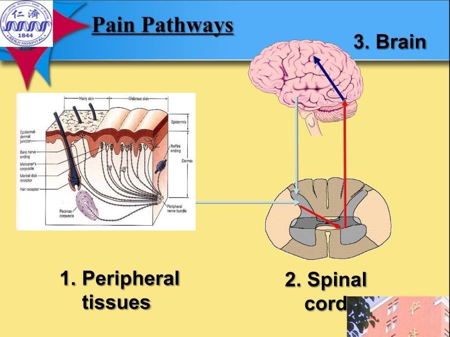 手术疼痛与慢性痛内在联系20110527 蚌医课件_第5页