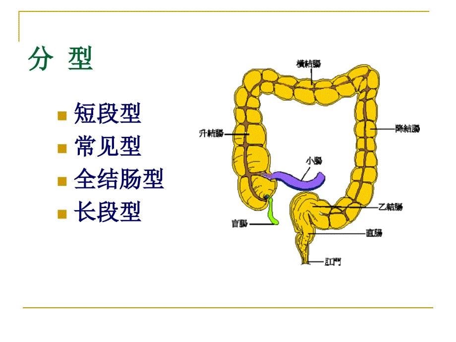 先天性巨结肠课件_7_第5页