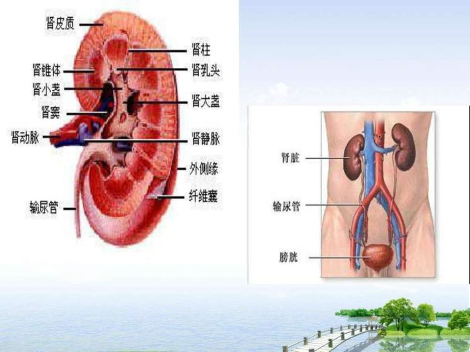 左肾癌的护理课件_第3页