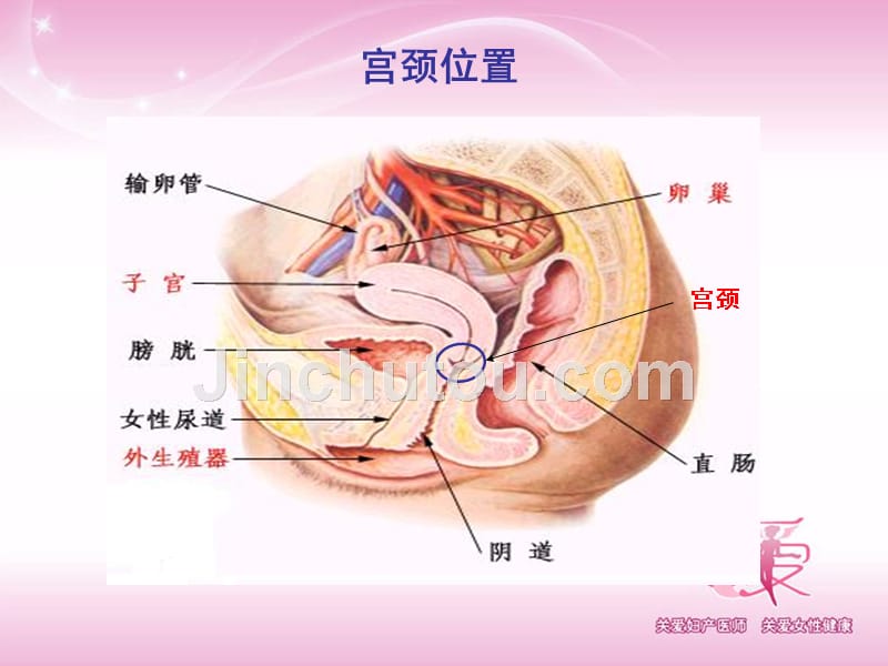 宫颈炎的优化治疗课件_第4页