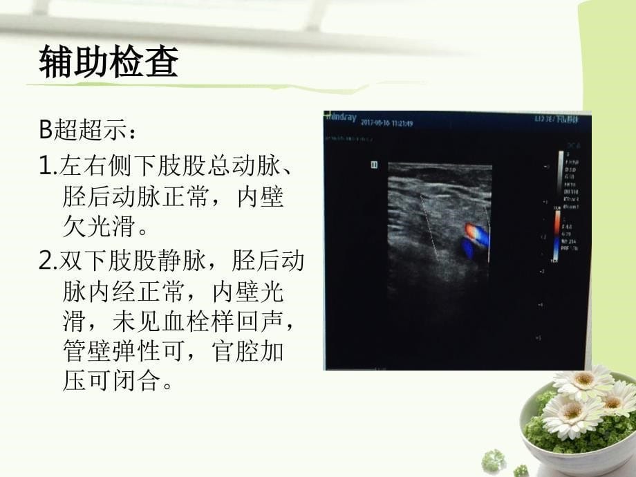 下肢静脉血栓护理查房2ppt课件_第5页