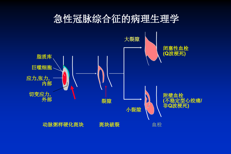 不稳定型心绞痛和无st段抬高的心肌梗死患者的治疗（2004年4月20日上课用）课件_第3页