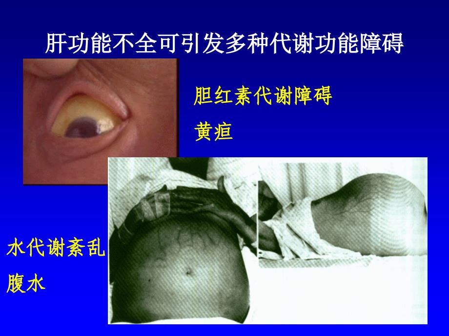 实验性肝性脑病ppt课件_第4页