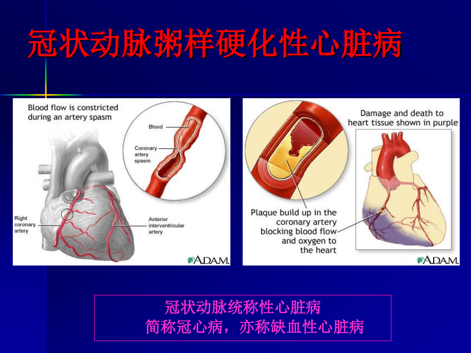 中医药对冠心病稳定性心绞痛长期治疗价值课件_第4页