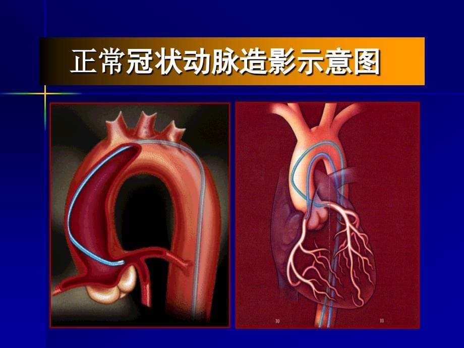 中医药对冠心病稳定性心绞痛长期治疗价值课件_第5页