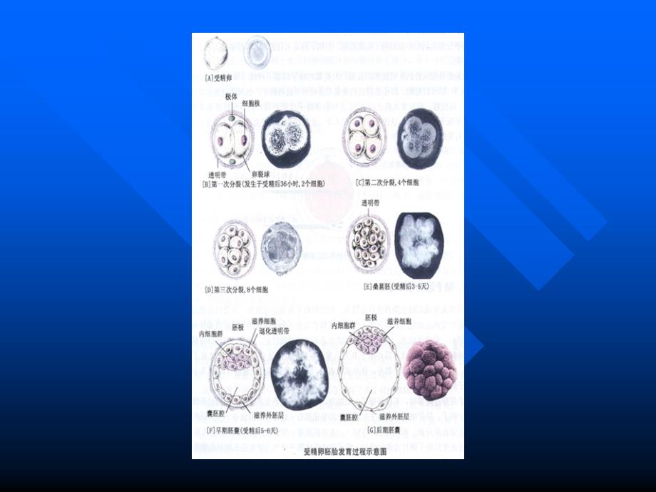 医学生殖医学男性不育及男性节育human 课件_第3页