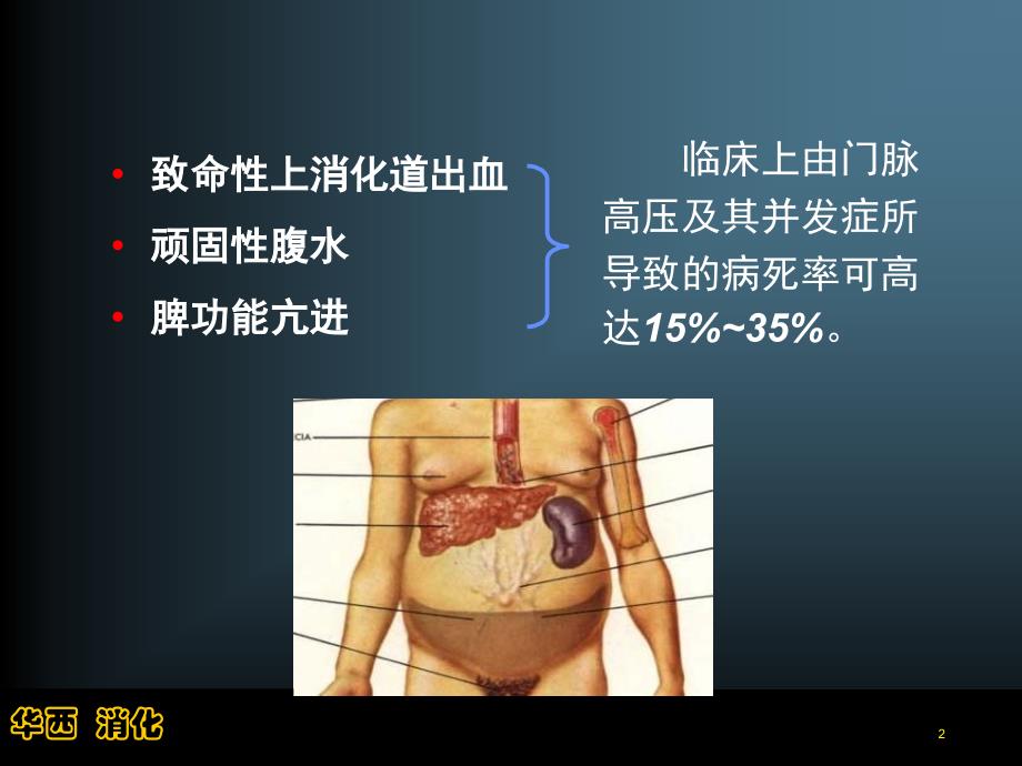 生物医学肝硬化门脉高压的介入治疗（四川大学华西医院消化内科唐承薇）课件_第2页