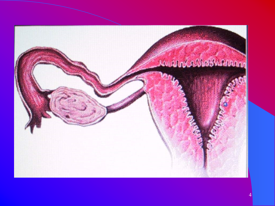 子宫内膜异位症和子宫腺肌病（ppt63）课件_第4页
